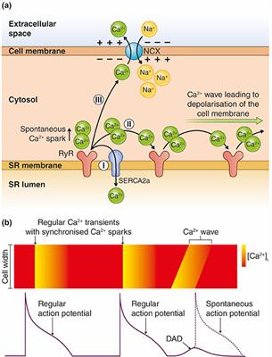 Hypokalemia-Induced Arrhythmias and Heart Failure: New Insights and Implications for Therapy